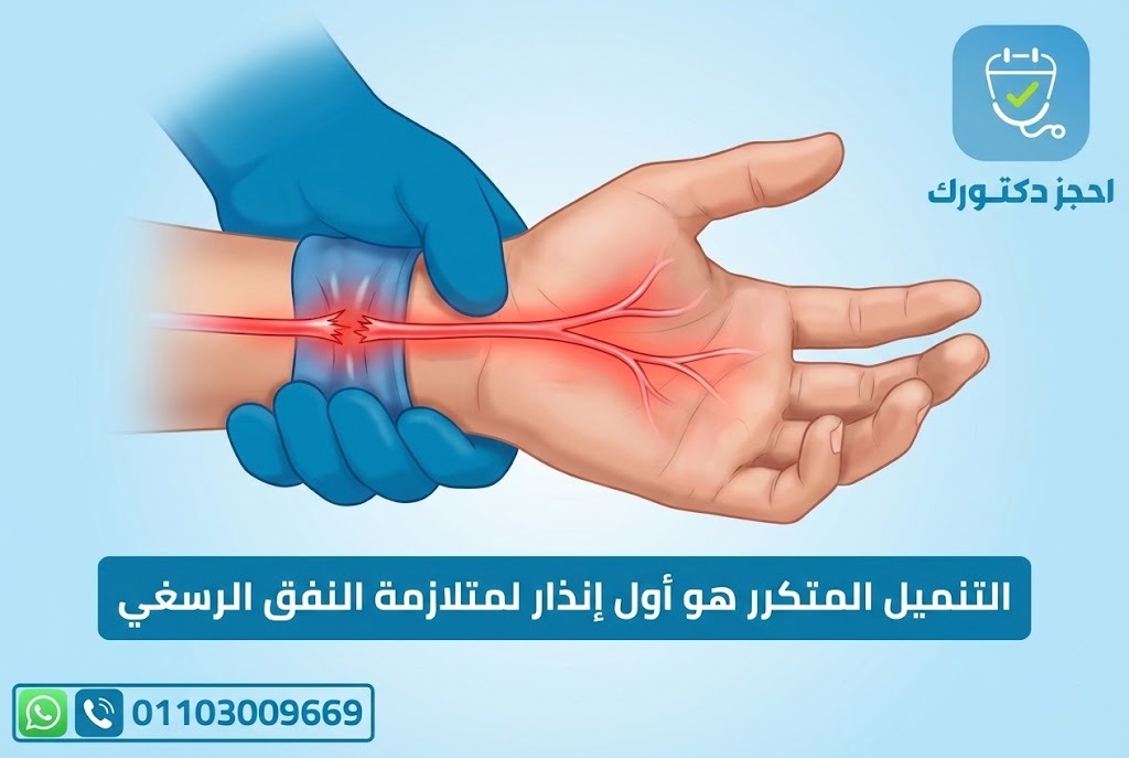 "صورة توضح رسغ اليد والعصب المتوسط داخل النفق الرسغي، موضحة الضغط على العصب المسبب لألم وتنميل الأصابع."