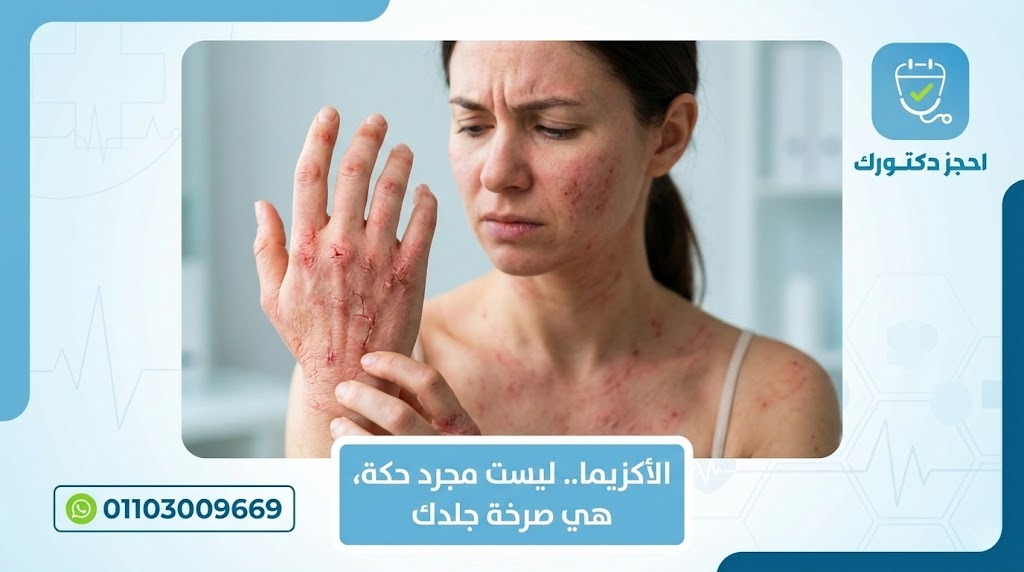 توضح الصورة ذراع شخص مصاب بالإكزيما، مع احمرار وتقشر الجلد، إلى جانب كريم ترطيب وزيوت طبيعية، لتعكس طرق علاج الإكزيما والعناية بالبشرة