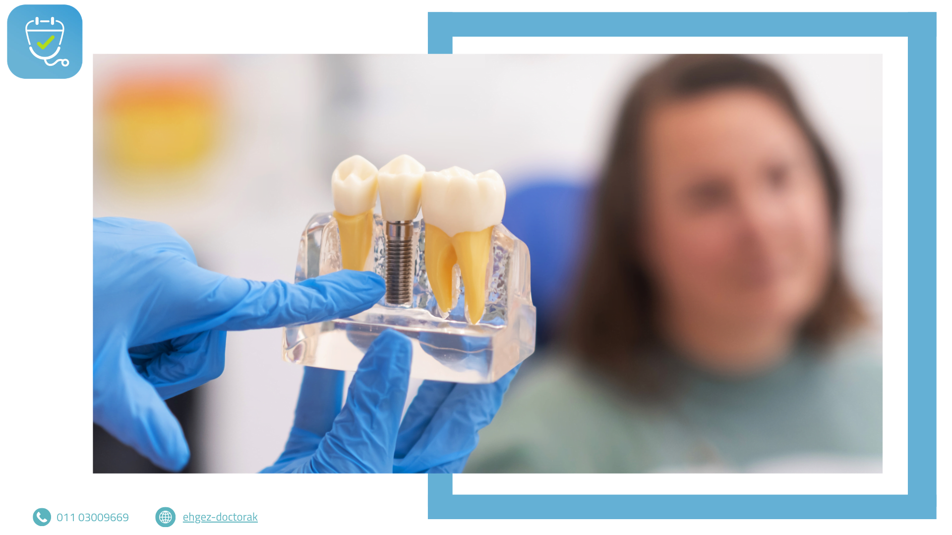 زراعة الأسنان